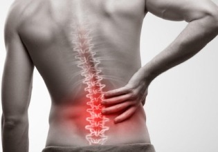 Facet Joint Syndrome
