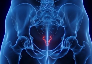Tailbone Pain
