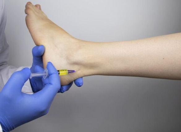 Achilles Tendinitis3