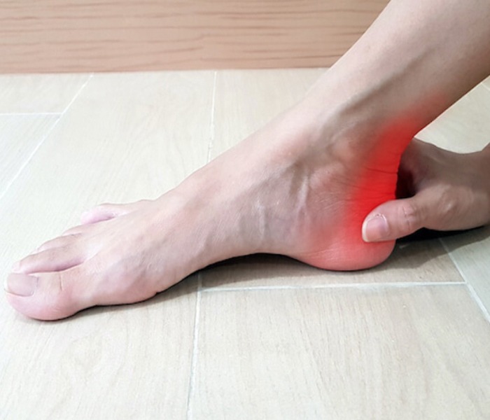 Achilles Tendinitis5