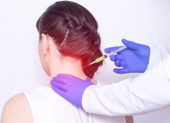 Cervical Epidural intervention Prolotherapy neck pain
