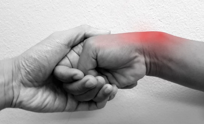 De Quervain's Tenosynovitis1