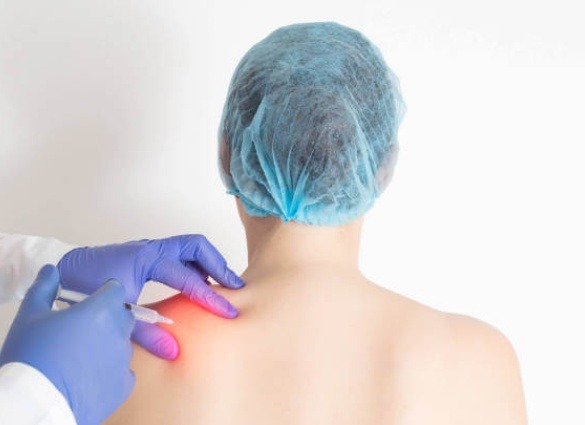 Fibromyalgia Infusions injuction