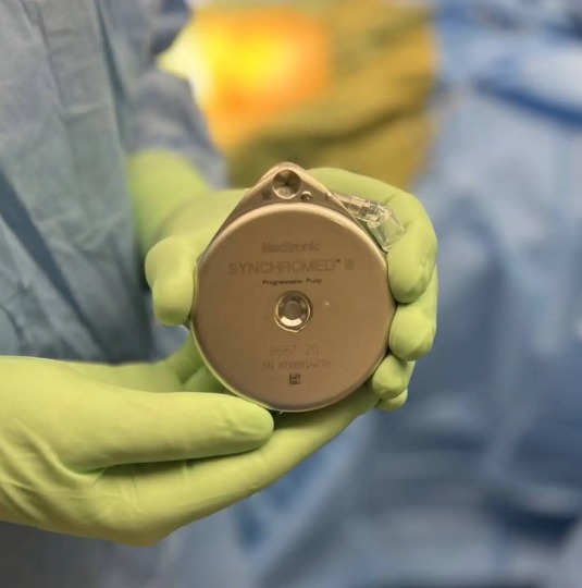 Intrathecal Pump benefits