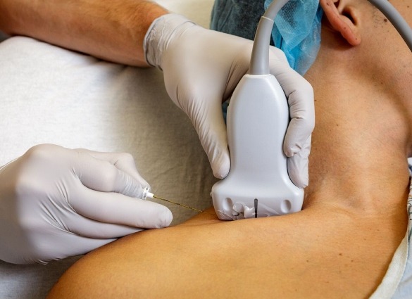 Nerve blocks treatment