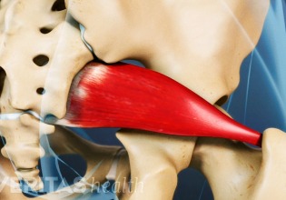 Piriformis Syndrome-diagnosis