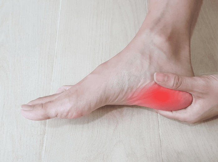 Plantar Fasciitis2