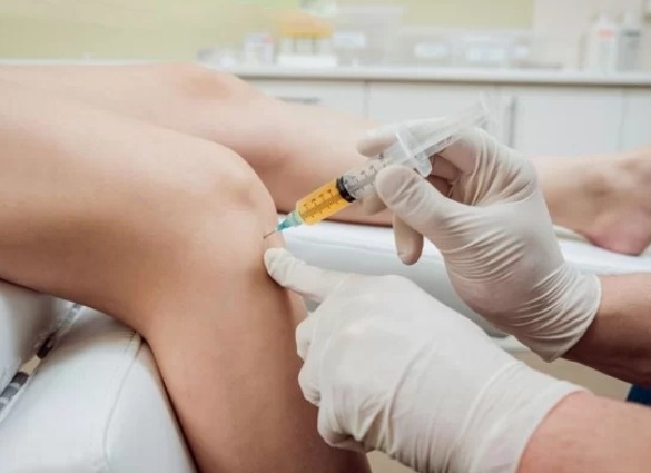 Prolotherapy, Stem cell treatments for knee