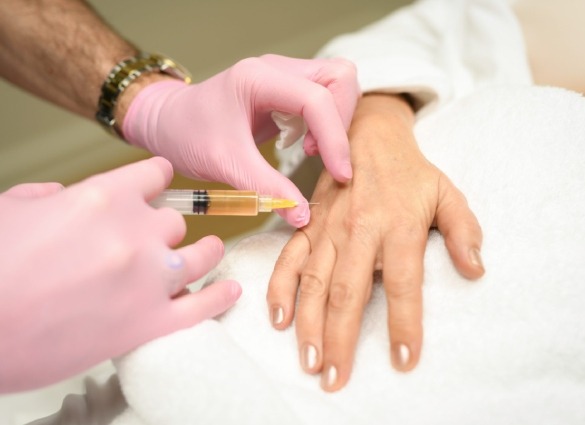 Prolotherapy treatment for hand