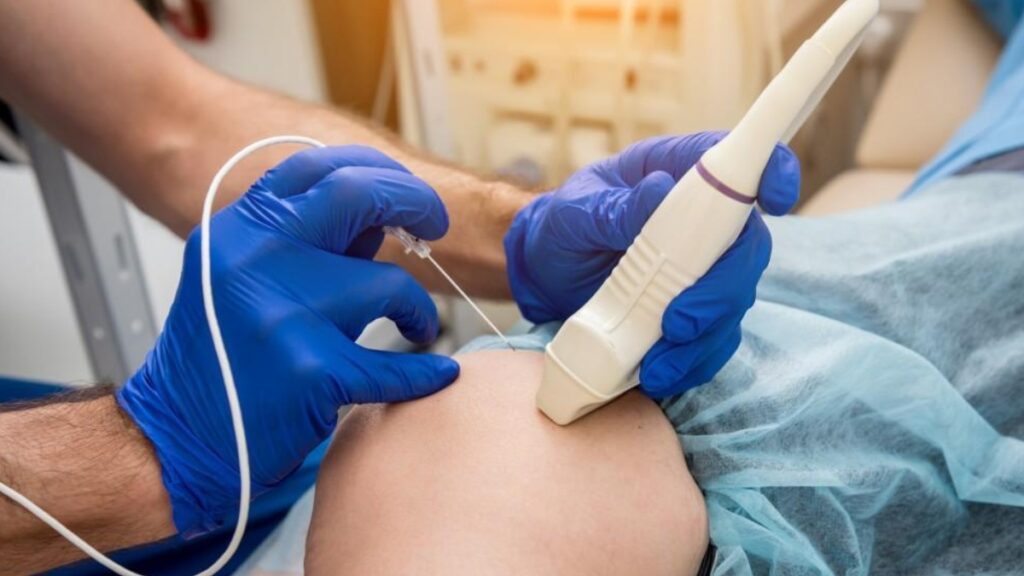 Radiofrequency Ablation: A Minimally Invasive Pain Relief Option