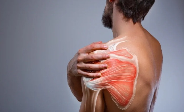 Rotator Cuff Injuries1