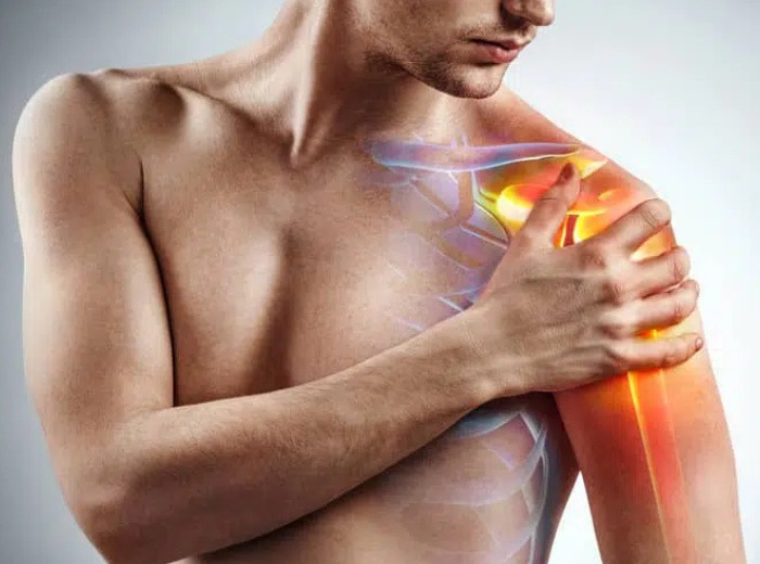 Rotator Cuff Injuries2