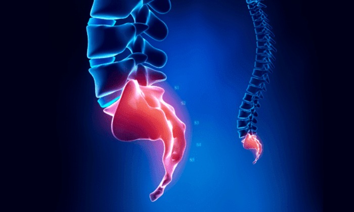 Tail-bone Pain