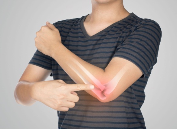 Tennis Elbow-pain intervention