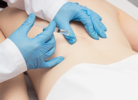 pain intervention for back pain
