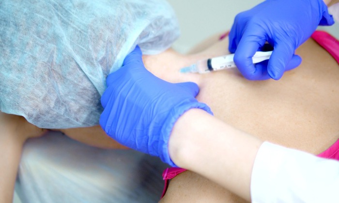 Cervical Epidural Injection1