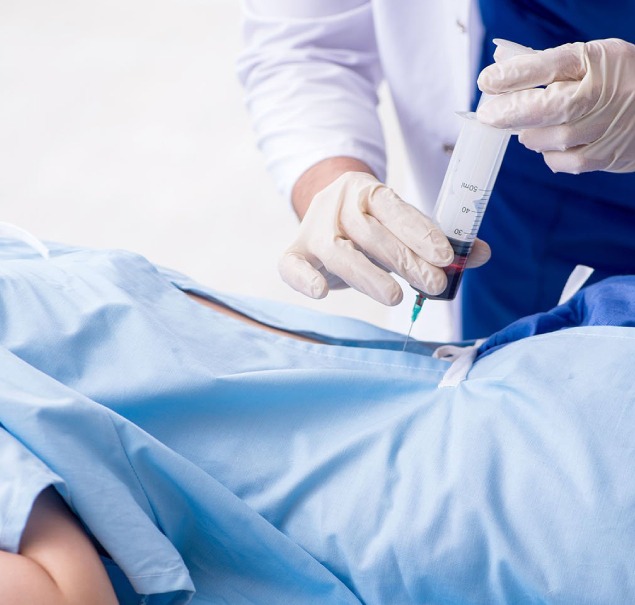 Cervical Epidural Injection2
