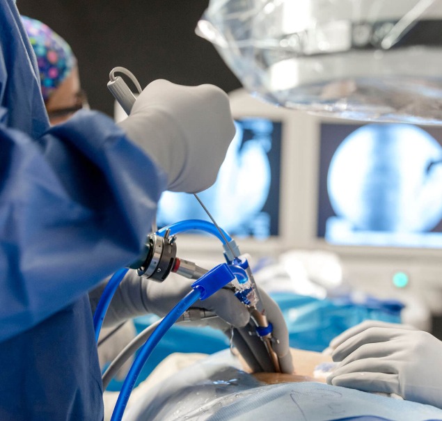 Endoscopic Discectomy2
