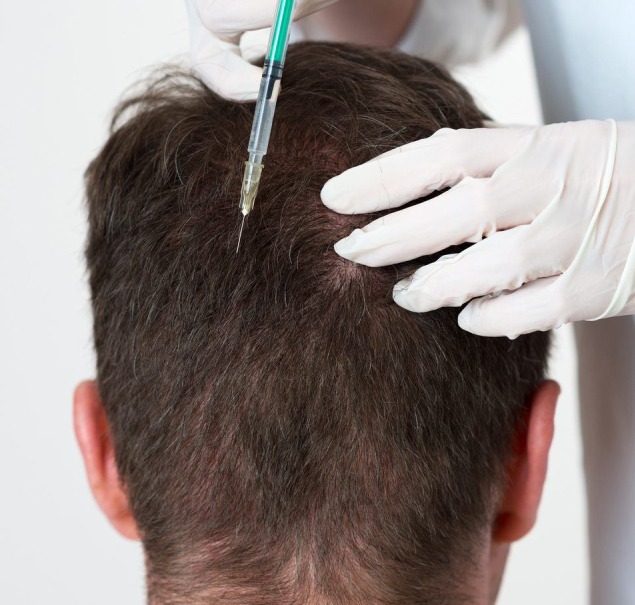 Occipital Nerve Block2