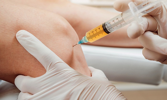 Platelet-Rich Plasma (PRP) Therapy