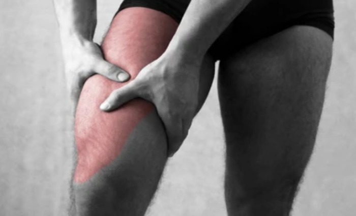 Quadriceps Tendinitis