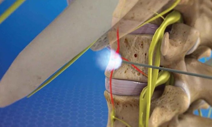 Sympathetic Nerve Block1