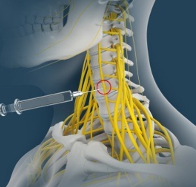 Sympathetic Nerve Block2