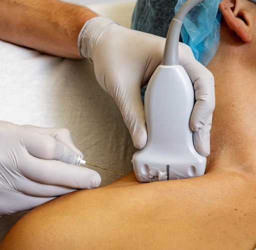 USG-Guided Interventions