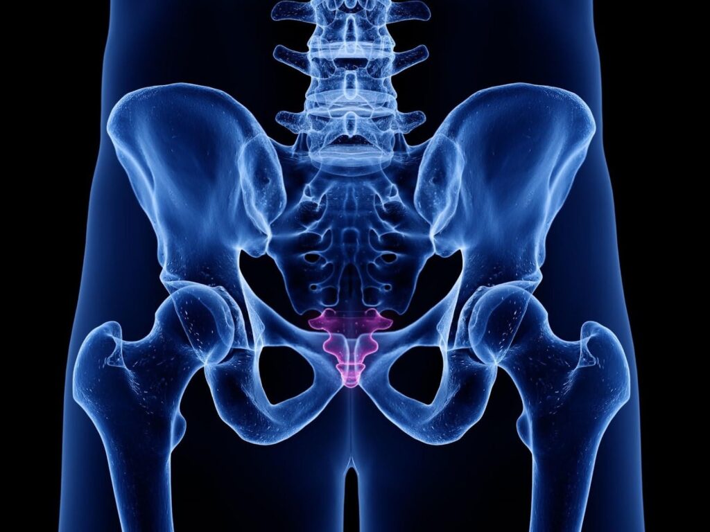 Prolotherapy for Coccydynia: A Natural Way to Heal Tailbone Pain