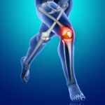 Knee Pain and Swelling: Causes and Effective Treatments